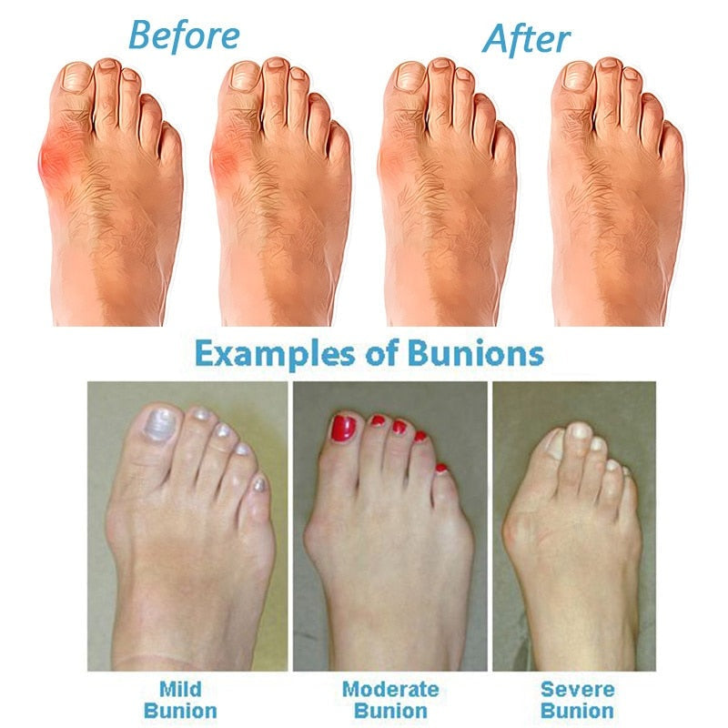 sandals – 2