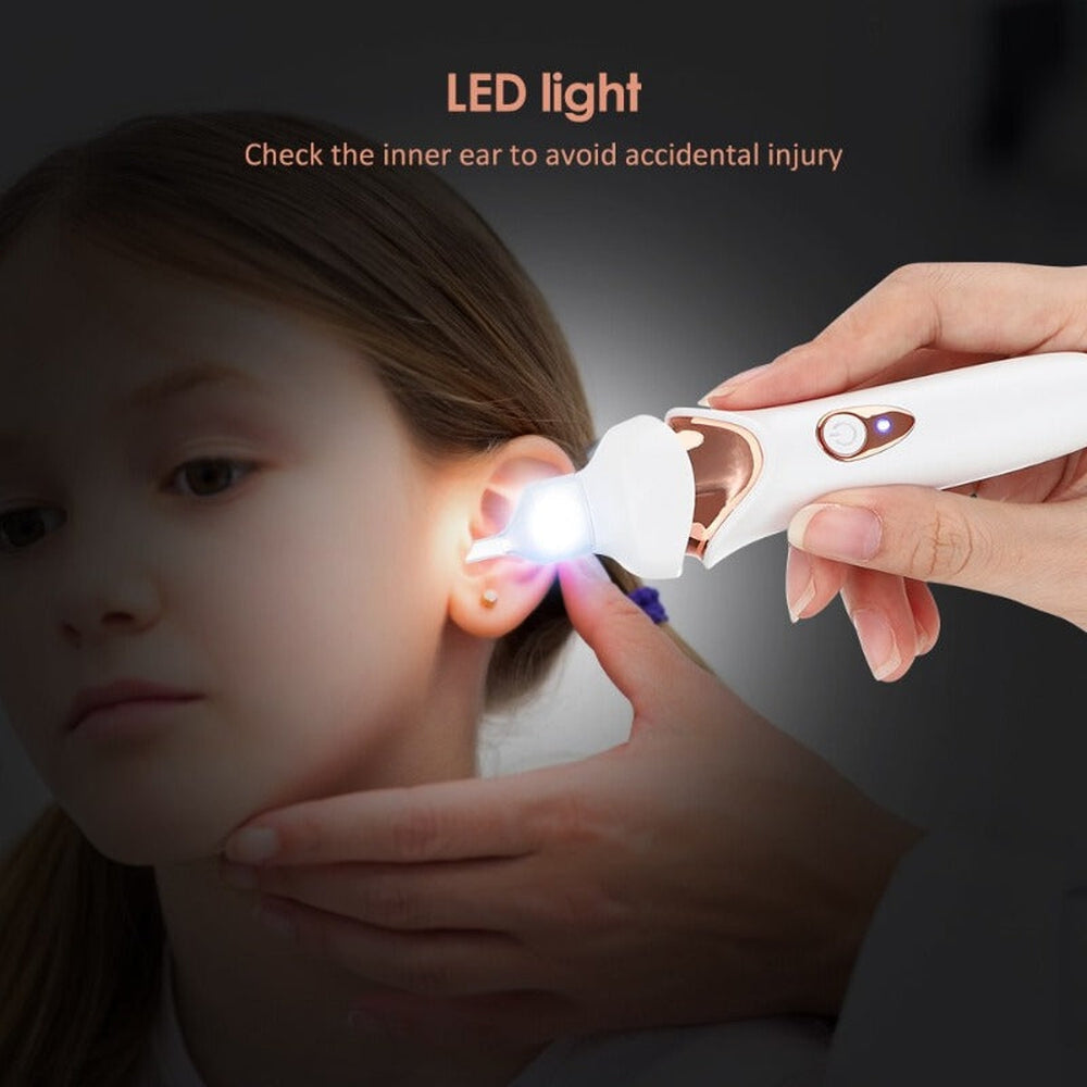 painless electric earwax removal vacuum – Aurum De London