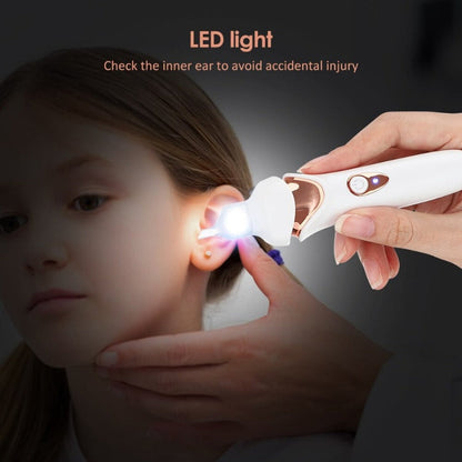 painless electric earwax removal vacuum – Aurum De London